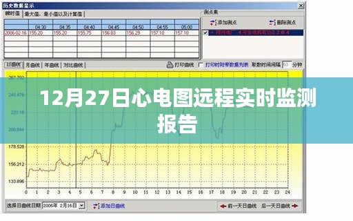 心電圖遠程實時監測報告,實時數據監測,健康無憂